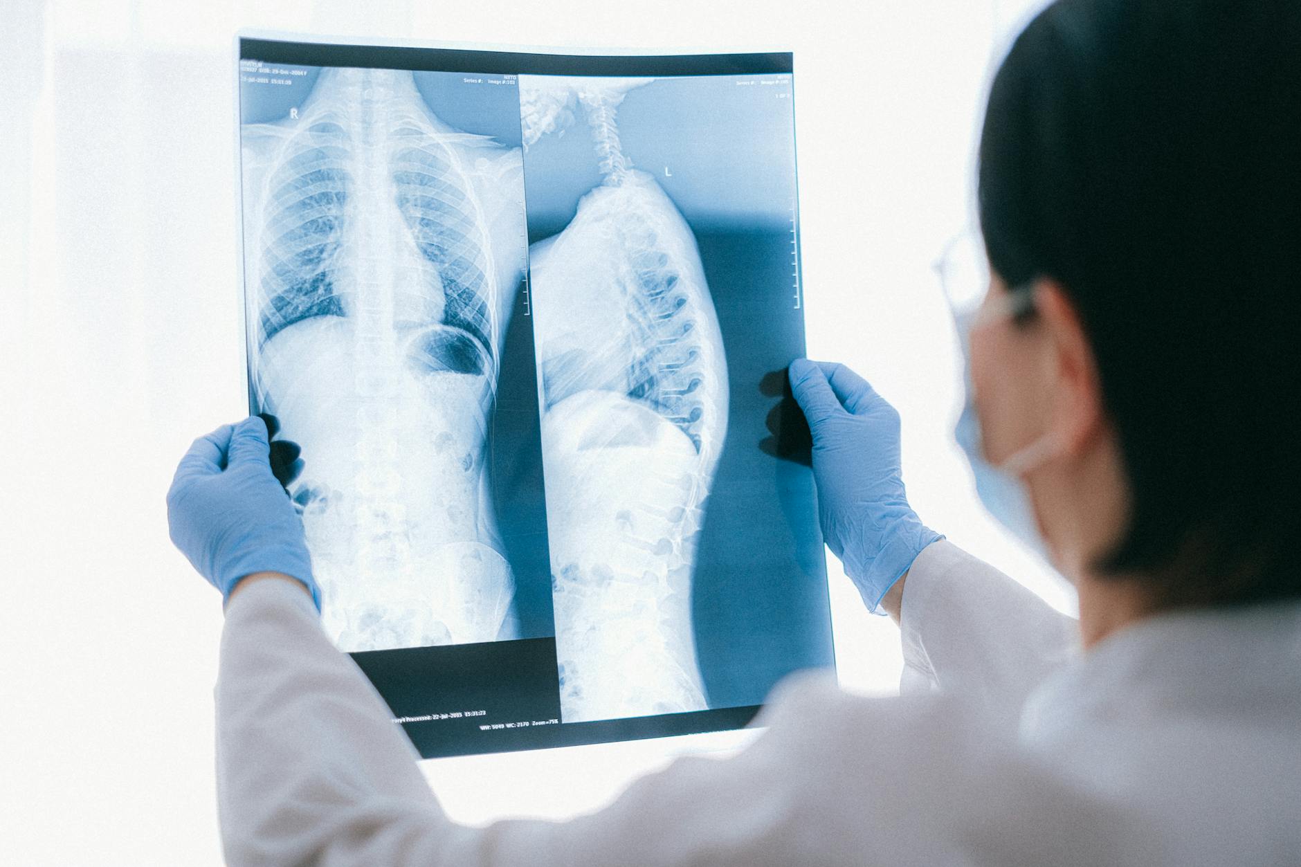 Médico revisando radiografía con paciente